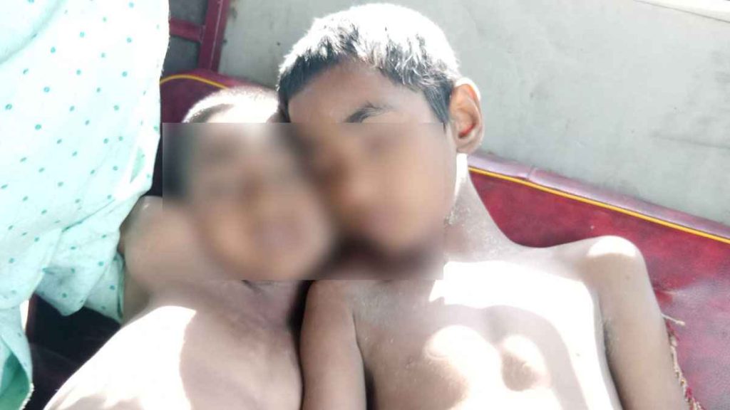 নাটোরে পুকুরে ডুবে দুই ভাইয়ের মৃত্যু