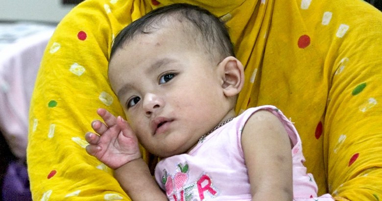 হামের উপসর্গে আরও ১১ জনের মৃত্যু