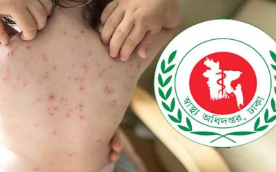 হাম ও হামের উপসর্গ নিয়ে আরও ৭ জনের মৃত্যু