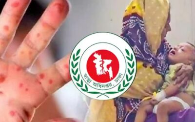 সারা দেশে হাম উপসর্গে আরও ৩ শিশুর মৃত্যু