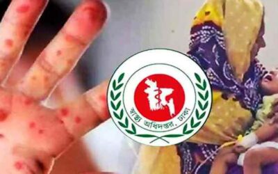 হামে আক্রান্ত শিশুদের ৬৫ শতাংশ পুষ্টিহীনতায় ছিলো: গবেষণা