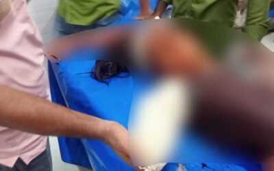 মেহেরপুরে বাড়িতে ঢুকে প্রাক্তন স্ত্রীর হাত কুপিয়ে বিচ্ছিন্ন, অভিযুক্ত গ্রেফতার