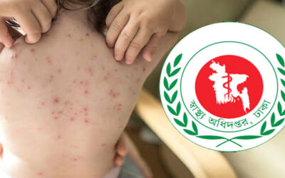 হামের উপসর্গ নিয়ে আরও ৭ জনের মৃত্যু